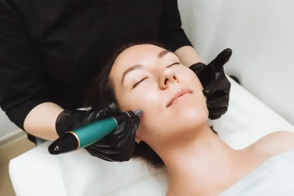 SkinPen microneedling by Gig Harbor Aesthetics in Gig Harbor WA