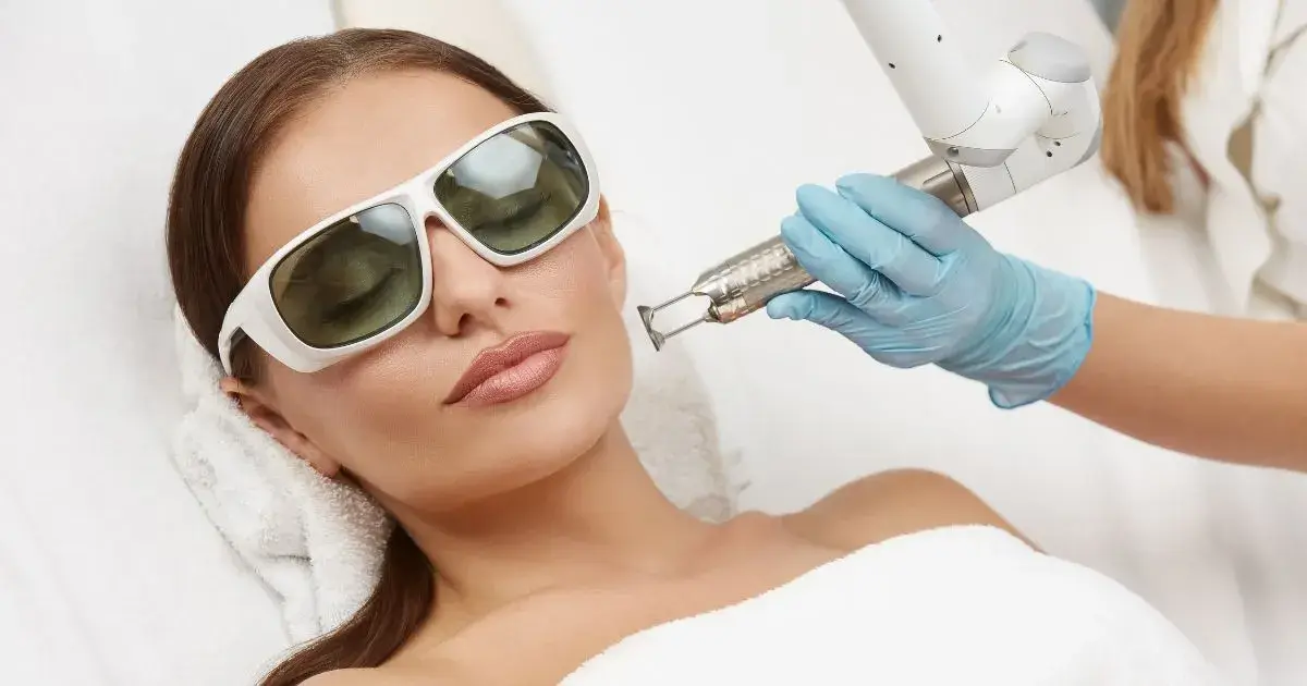 NanoLaser Peel procedure on a woman's face in Gig Harbor, WA