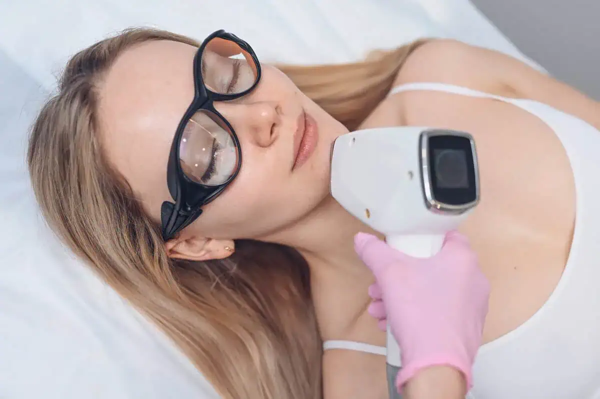 Patient receiving a laser skin rejuvenation treatment in Gig Harbor, WA.