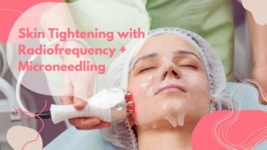 Skin Tightening with Radiofrequency and Microneedling | Gig Harbor Aesthetics | Gig Harbor, WA