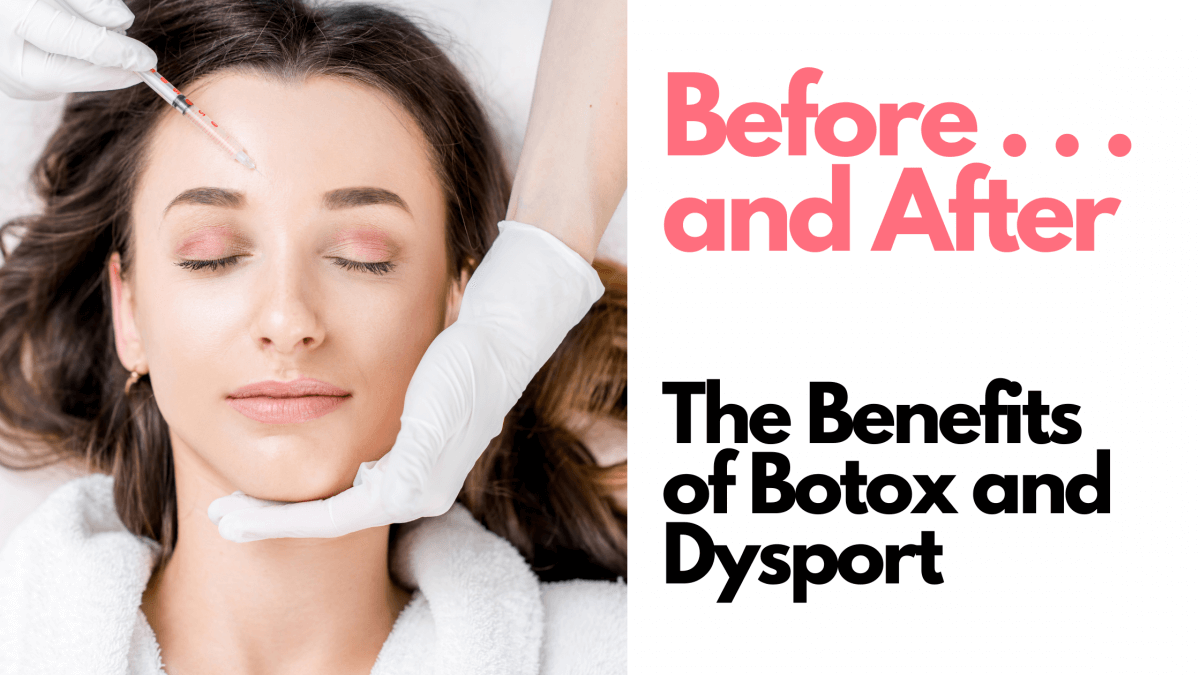 The Benefits of Botox and Dysport: Before . . . and After