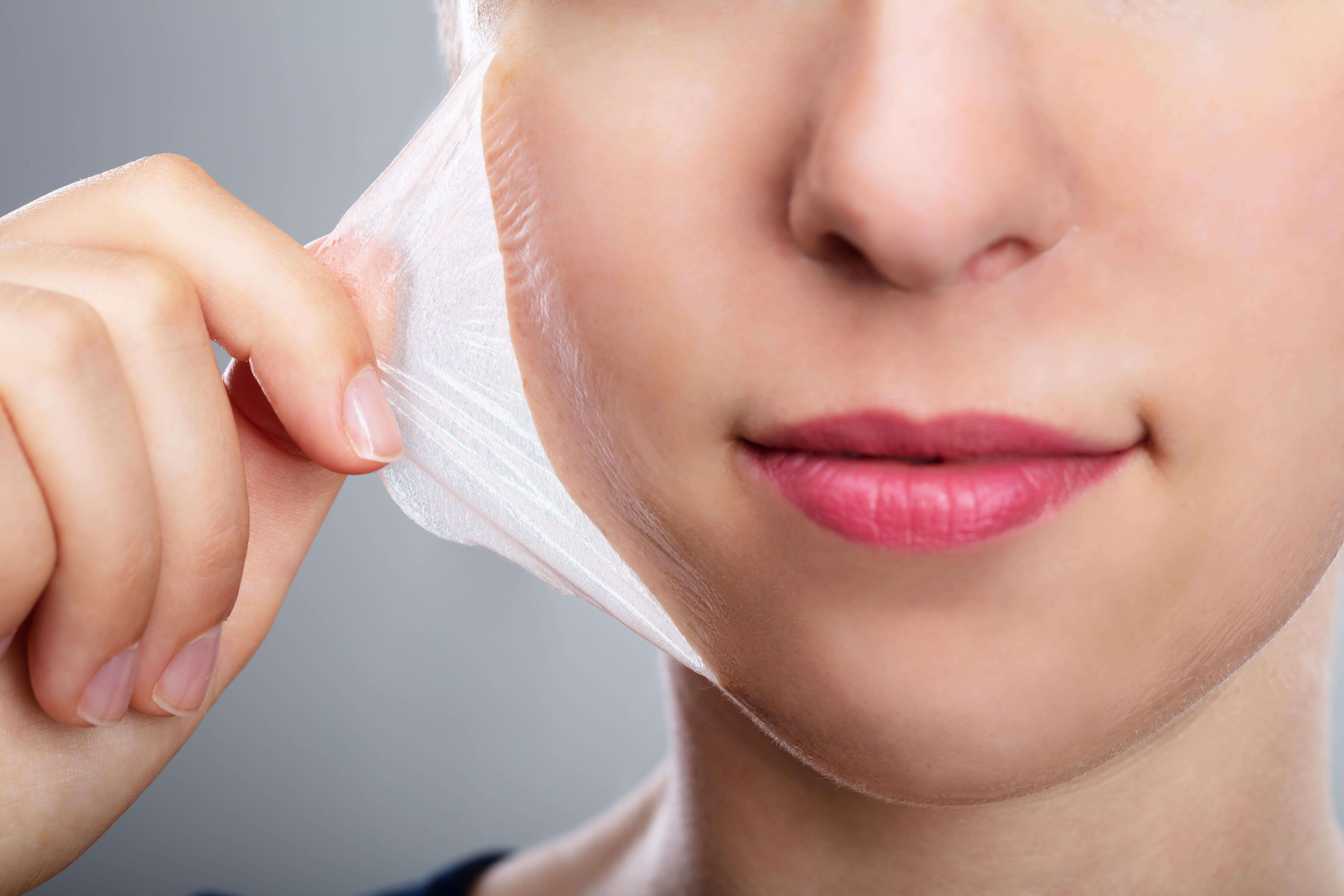 Chemical Peeling by Gig Harbor Aesthetics in Gig Harbor WA