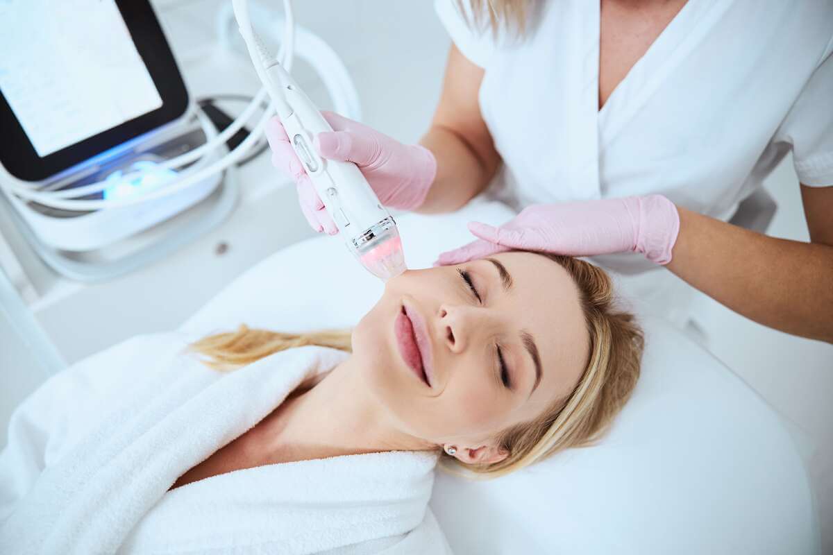RF Microneedling by Gig Harbor Aesthetics in WA